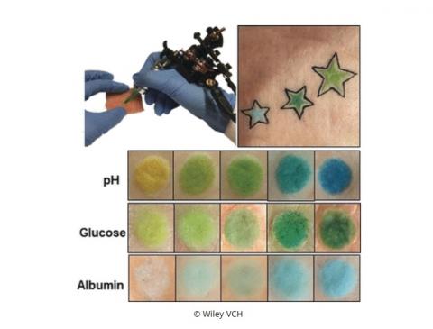 La couleur du tatouage varie avec le changement de différents biomarqueurs, dont le pH du sang. La couleur du tatouage varie avec le changement de différents biomarqueurs, dont le pH du sang.