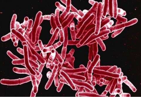 L’une des clés pour éradiquer cette infection mondiale majeure, la tuberculose, qui fait chaque année plus de 1,5 million de décès, serait de développer in traitement suffisamment efficace contre les formes ultra-résistantes de la maladie, mais aussi un traitement plus court (Visuel NIAID) L’une des clés pour éradiquer cette infection mondiale majeure, la tuberculose, qui fait chaque année plus de 1,5 million de décès, serait de développer in traitement suffisamment efficace contre les formes ultra-résistantes de la maladie, mais aussi un traitement plus court (Visuel NIAID)