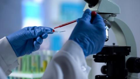 9 des 373 protéines identifiées pourraient déjà apporter des prédictions très satisfaisantes et donner lieu à un home test qui permettrait à chacun de suivre son vieillissement biologique. 9 des 373 protéines identifiées pourraient déjà apporter des prédictions très satisfaisantes et donner lieu à un home test qui permettrait à chacun de suivre son vieillissement biologique.
