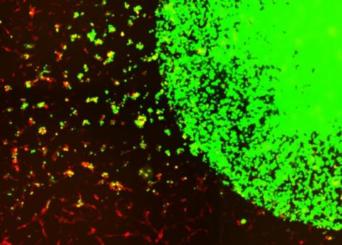 Il s'agit d'une nouvelle thérapie cellulaire standard pour cibler et tuer les cellules tumorales restantes dans le cerveau, après la chirurgie, chez les patients atteints de glioblastome (Visuel Shah lab (CSTI)) Il s'agit d'une nouvelle thérapie cellulaire standard pour cibler et tuer les cellules tumorales restantes dans le cerveau, après la chirurgie, chez les patients atteints de glioblastome (Visuel Shah lab (CSTI))