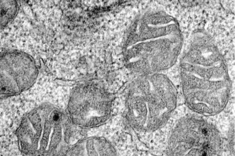 Ces cellules progénitrices érythroïdes se divisent pour fabriquer des globules rouges- mitochondries à l’intérieur de ces cellules Ces cellules progénitrices érythroïdes se divisent pour fabriquer des globules rouges- mitochondries à l’intérieur de ces cellules