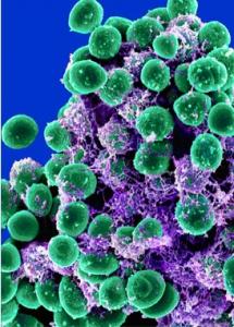 INFECTIONS NOSOCOMIALES: L'anti-biofilm nano qui repousse les