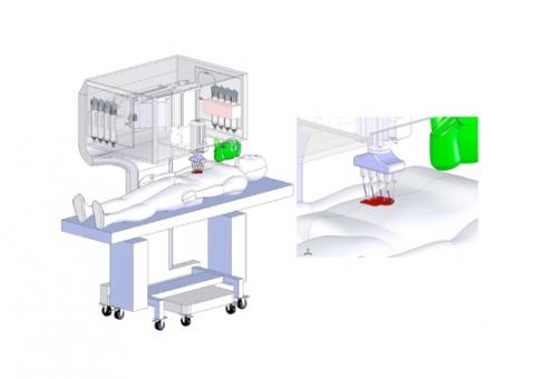 Une bio-imprimante de peau mobile, positionnable « in situ » soit au chevet du patient et qui, à partir de ses propres cellules (autologues) de peau va pouvoir imprimer de la peau, couche par couche, pour initier le processus de cicatrisation Une bio-imprimante de peau mobile, positionnable « in situ » soit au chevet du patient et qui, à partir de ses propres cellules (autologues) de peau va pouvoir imprimer de la peau, couche par couche, pour initier le processus de cicatrisation