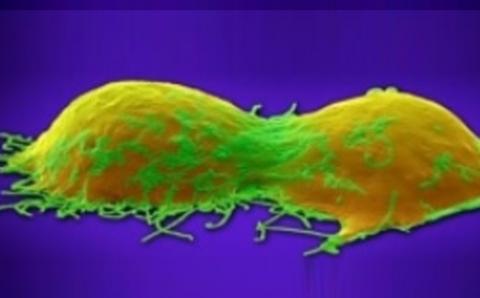 La leptine, un signal biologique libéré par le tissu adipeux qui aide à réguler l'appétit en signalant la sensation de satiété dans des conditions normales, peut être impliquée, en cas d’obésité, dans la résistance à certains traitements de chimiothérapie pour le cancer du sein. La leptine, un signal biologique libéré par le tissu adipeux qui aide à réguler l'appétit en signalant la sensation de satiété dans des conditions normales, peut être impliquée, en cas d’obésité, dans la résistance à certains traitements de chimiothérapie pour le cancer du sein.