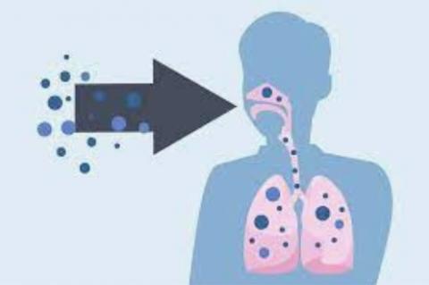 La mucormycose, une infection fongique invasive, qui touche ici les sinus et les poumons est une nouvelle complication documentée avec le COVID-19 (Visuel CDC) La mucormycose, une infection fongique invasive, qui touche ici les sinus et les poumons est une nouvelle complication documentée avec le COVID-19 (Visuel CDC)