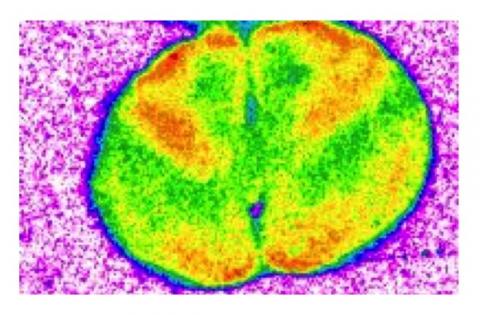 Les souris exposées à long terme au médicament présentent des troubles de la mémoire au point de ne plus pouvoir faire la distinction entre un objet familier et un nouvel objet Les souris exposées à long terme au médicament présentent des troubles de la mémoire au point de ne plus pouvoir faire la distinction entre un objet familier et un nouvel objet