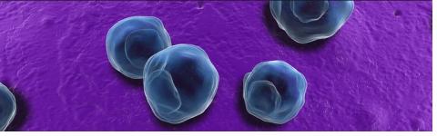 L'infection à chlamydia est l'infection bactérienne transmise sexuellement la plus répandue dans le monde. L'infection à chlamydia est l'infection bactérienne transmise sexuellement la plus répandue dans le monde.