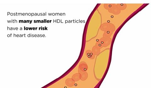 Chez les femmes ménopausées, une concentration plus élevée de particules de HDL est associée à un risque plus faible d'athérosclérose Chez les femmes ménopausées, une concentration plus élevée de particules de HDL est associée à un risque plus faible d'athérosclérose
