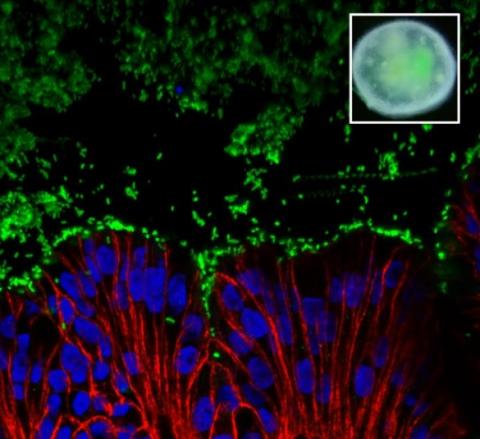 Parmi les premiers êtres vivants à accueillir le nouveau-né, ses premières bactéries, dont E. coli (en vert) Parmi les premiers êtres vivants à accueillir le nouveau-né, ses premières bactéries, dont E. coli (en vert)