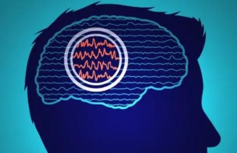 Si les crises pouvaient être prévues de manière fiable, les personnes épileptiques pourraient alors adapter en fonction leurs activités ou prendre un médicament à action rapide pour prévenir la crise ou minimiser ses effets (Visuel Mayo Clinic) Si les crises pouvaient être prévues de manière fiable, les personnes épileptiques pourraient alors adapter en fonction leurs activités ou prendre un médicament à action rapide pour prévenir la crise ou minimiser ses effets (Visuel Mayo Clinic).