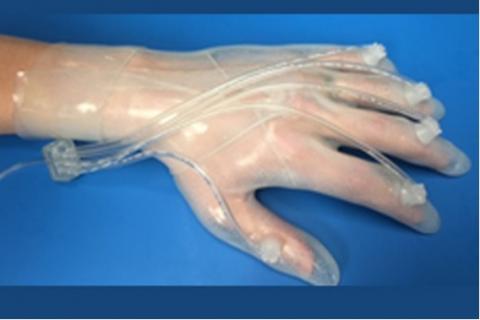 Ce gant cicatrisant répond en effet à un véritable besoin, à la fois sur les zones de combat mais aussi en santé communautaire : il permet d’accélérer la cicatrisation des plaies complexes de la main. Ce gant cicatrisant répond en effet à un véritable besoin, à la fois sur les zones de combat mais aussi en santé communautaire : il permet d’accélérer la cicatrisation des plaies complexes de la main.