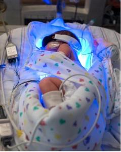 ICTÈRE du nouveau-né: La photothérapie accroît-elle le risque de ...