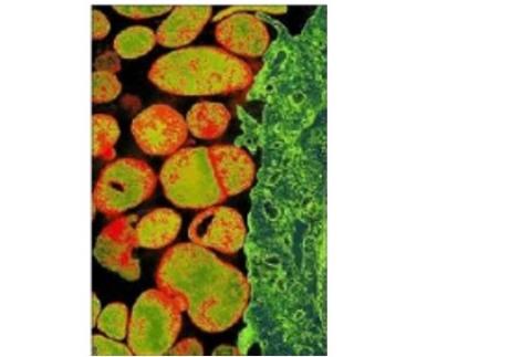 la bactérie qui envahit les cellules épithéliales des voies génitales et urinaires parfois aussi les cellules du rectum et des poumons, peut conduire à l'infertilité dans certains cas. la bactérie qui envahit les cellules épithéliales des voies génitales et urinaires parfois aussi les cellules du rectum et des poumons, peut conduire à l'infertilité dans certains cas.