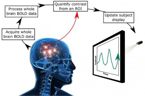 Le neurofeedback est en effet capable de réduire la sévérité des acouphènes ou même de les éliminer chez certains patients. Le neurofeedback est en effet capable de réduire la sévérité des acouphènes ou même de les éliminer chez certains patients.