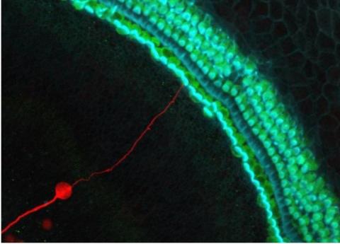 Il s'agit d'abord de surexprimer un gène, NEUROG1, pour transformer les cellules souches de l'oreille interne en neurones auditifs Il s'agit d'abord de surexprimer un gène, NEUROG1, pour transformer les cellules souches de l'oreille interne en neurones auditifs