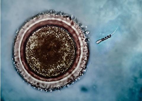 Une baisse estimée de 50 à 60% du nombre de spermatozoïdes dans les pays développés Une baisse estimée de 50 à 60% du nombre de spermatozoïdes dans les pays développés
