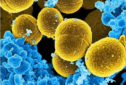 Les patients séropositifs traités par antirétroviraux et présentant des taux élevés d'autoanticorps présentent également des taux élevés de bactéries Staphylococcus aureus (Visuel) dans le sang Les patients séropositifs traités par antirétroviraux et présentant des taux élevés d'autoanticorps présentent également des taux élevés de bactéries Staphylococcus aureus (Visuel) dans le sang