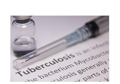 TUBERCULOSE : Le test sanguin qui la détecte 2 ans avant | santé log