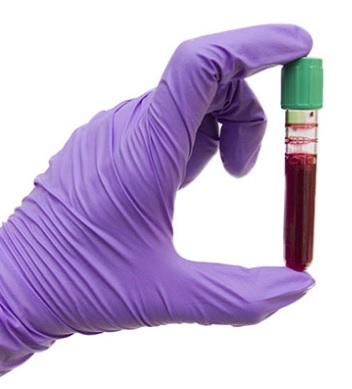 Une analyse de sang seule va laisser passer un grand nombre d’aspects du vieillissement, environ 7 ou 8 autres aspects de la physiologie qui pourraient contribuer à apporter une mesure plus fiable de l'âge biologique Une analyse de sang seule va laisser passer un grand nombre d’aspects du vieillissement, environ 7 ou 8 autres aspects de la physiologie qui pourraient contribuer à apporter une mesure plus fiable de l'âge biologique