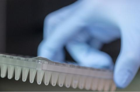 Ce test sanguin peut prédire la résistance tumorale prostatique face aux principaux anticancéreux Ce test sanguin peut prédire la résistance tumorale prostatique face aux principaux anticancéreux