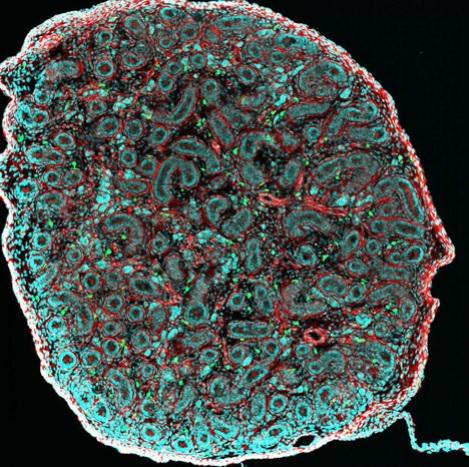 Des macrophages testiculaires se mobilisent pour défendre les spermatozoïdes Des macrophages testiculaires se mobilisent pour défendre les spermatozoïdes