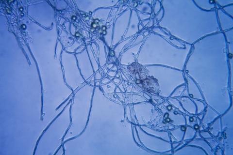 Dans les cas de la tête et du cou, la « moisissure » pénètre généralement par les voies respiratoires impliquant le nez et les sinus, avec une progression possible dans les structures orbitales et intracrâniennes (Visuel Adobe Stock 194523431)