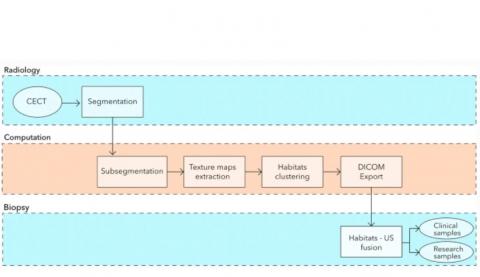 Ces travaux marquent une avancée dans la capture de l'hétérogénéité des tumeurs en utilisant des moyens d’imagerie standard(Visuel Evis Sala/University of Cambridge)