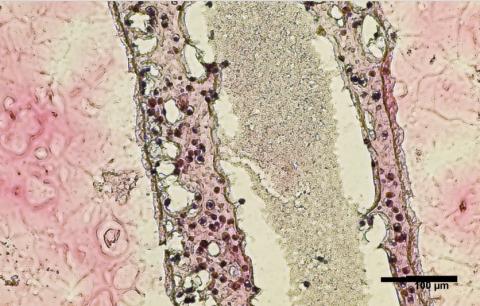 Les cellules ont été cultivées et imprimées en 3D dans ne boîte de Pétri dans une structure tubulaire creuse qui ressemble aux tubes séminifères humains producteurs de sperme (Visuel Courtesy of Dr. Ryan Flannigan)