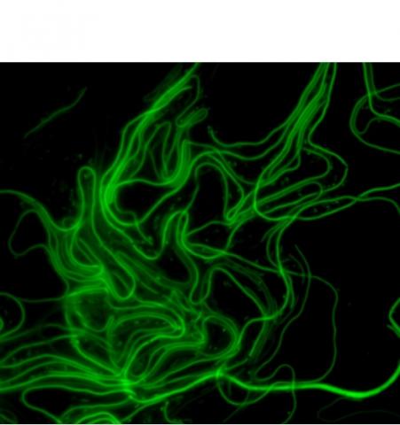 Les bactéries sous forme de filaments, donc pendant cette phase de métamorphose, n’obéissent pas aux règles normales de la division cellulaire (Visuel Australian Institute for Microbiology and Infection, University of Technology Sydney)