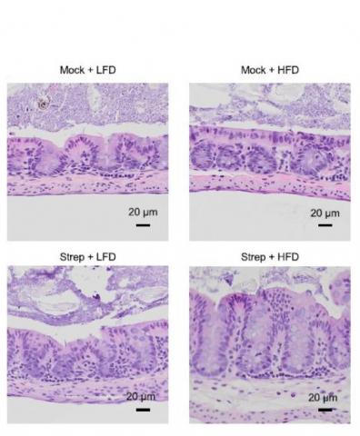 Des sections de muqueuse interne du côlon, avec régime allégé en graisses (LFD), régime riche en graisses (HFD), aucun traitement et traitement à la streptomycine (Strep). (Visuel2 UC Davis Health)