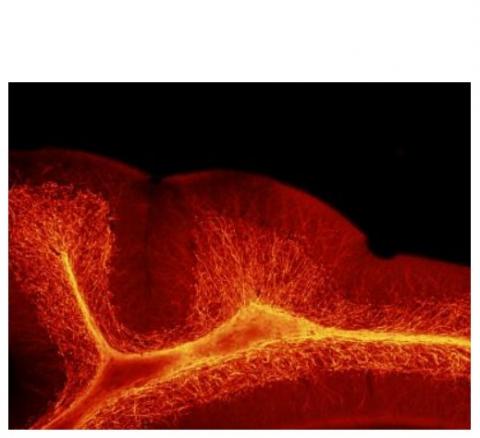 Sans ALLO, les chercheurs constatent une augmentation de l'épaisseur de la myéline, la couche isolante riche en lipides qui protège les fibres nerveuses.