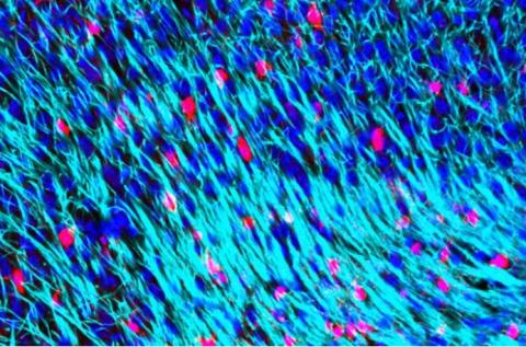 La myéline (en bleu) est un isolant produit par des cellules Oligodendrocytes, produites elles-mêmes par les cellules progénitrices Oligodendrocytes (OPCs) (Visuel Dr Andrea Rivera).