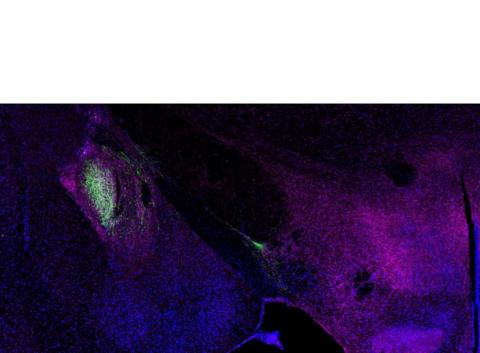 Neurones à neurotensine (en vert ), présents dans le noyau central de l'amygdale