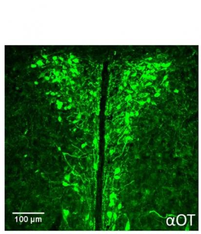 Cellules productrices d'ocytocine dans le noyau paraventriculaire d'un hypothalamus de souris