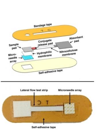 si les micro-aiguilles et les bandelettes de test d'anticorps ont été largement étudiées et développées, c’est la première fois que ces 2 technologies sont combinées en un dispositif simple et peu coûteux