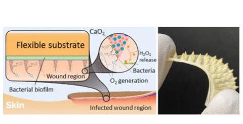 Lorsque ces micro-aiguilles traversent le bouclier, elles absorbent l’exsudat et se dissolvent, ce qui délivre l'antibiotique directement aux cellules et tissus ulcérés (Schéma l'Université Purdue / Vincent Walter)