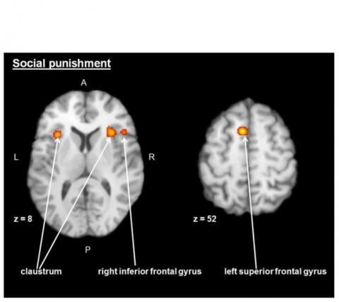 Les zones du claustrum bilatéral, du gyrus frontal supérieur gauche et frontal intérieur droit sont toujours activés lors de cette fonction de punition sociale. 