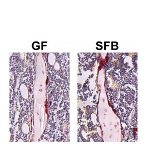 La présence de SFB dans un microbiote complexe entraîne une réduction du volume osseux trabéculaire