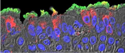 Le virus (en rouge) se reproduit plus rapidement dans les cellules nasales que dans les cellules ciliées des bronches (visuel Takanori Asakura, PhD, UNC School of Medicine)