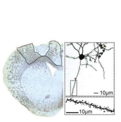 L'activité de la microglie pourrait être responsable de l'augmentation des épines dendritiques