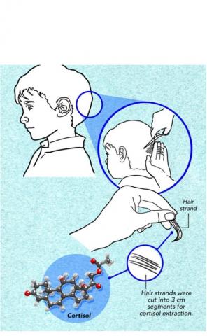 L’analyse révèle une concentration accrue de cortisol dans les cheveux des enfants, confirmant des niveaux de stress élevés lors des 3 premiers mois de pandémie (Visuel NYU Abu Dhabi)