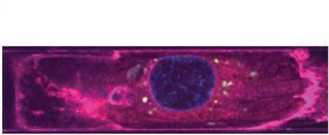 VEs dérivés de l'endothélium (vert) autour des noyaux (bleu) d'un cardiomyocyte (magenta) (Visuel Disease Biophysics Group / Harvard SEAS) 