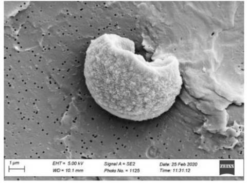 Bactérie marine Vibrio parahaemolyticus en dormance, qui peut se réveiller et provoquer une gastro-entérite chez l'homme ( Visuel University of Exeter Bioimaging Unit)