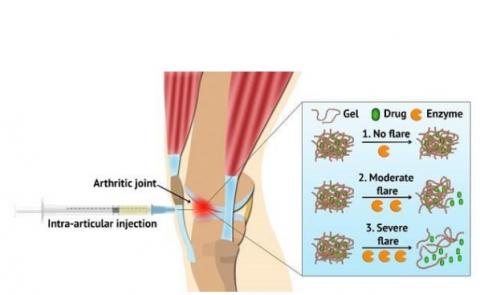 L'hydrogel injecté localement se dégrade plus rapidement en cas d’arthrite ou de crises sévères L'hydrogel injecté localement se dégrade plus rapidement en cas d’arthrite ou de crises sévères