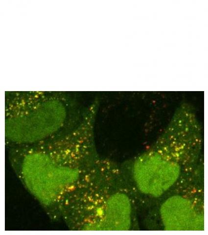 Processus d'autophagie dans les cellules. Points verts et jaunes: autophagosomes; points rouges: autophagosomes fusionnés avec des lysosomes
