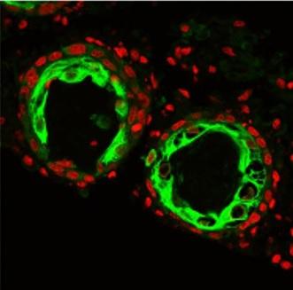 2 types de cellules progénitrices de la peau épidermiques (vertes sur le visuel) et dermiques (rouge) subissent une série de transitions morphologiques pour former une peau reconstituée.