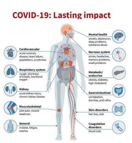 Le COVID-19 a déjà entraîné une charge de morbidité très élevée et l'étendue de l'implication du système organique est considérablement plus importante qu’avec d'autres virus respiratoires (Visuel Sara Moser)