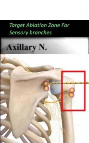 Visuel Radiological Society of North America