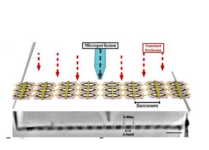 Des micro-aiguilles permettent aux chercheurs d'évaluer la force de la contraction musculaire