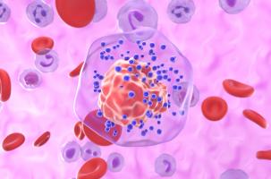 Cette étude suggère de nouvelles options thérapeutiques permettant de bloquer l'accumulation d'acides gras et les signaux immunosuppresseurs associés (Visuel Adobe Stock 1031587846)